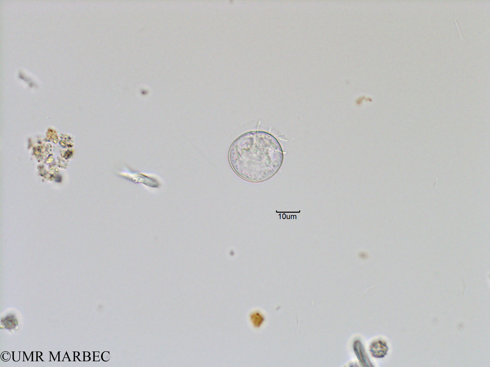 phyto/Bizerte/bizerte_bay/RISCO November 2015/Dinophysis bibulba (Baie_T5-C1-Dinophysis-7).tif(copy).jpg